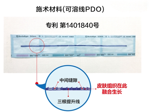 普罗菲耳朴明旭小切口手术提升专利施术材料